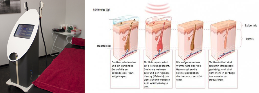 Cellsan Haarentfernung Mit Ipl Und Warmwachs